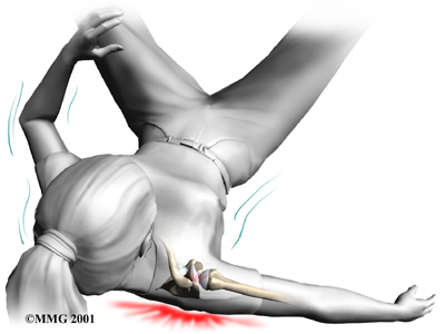 Klassischer Unfallmechanismus